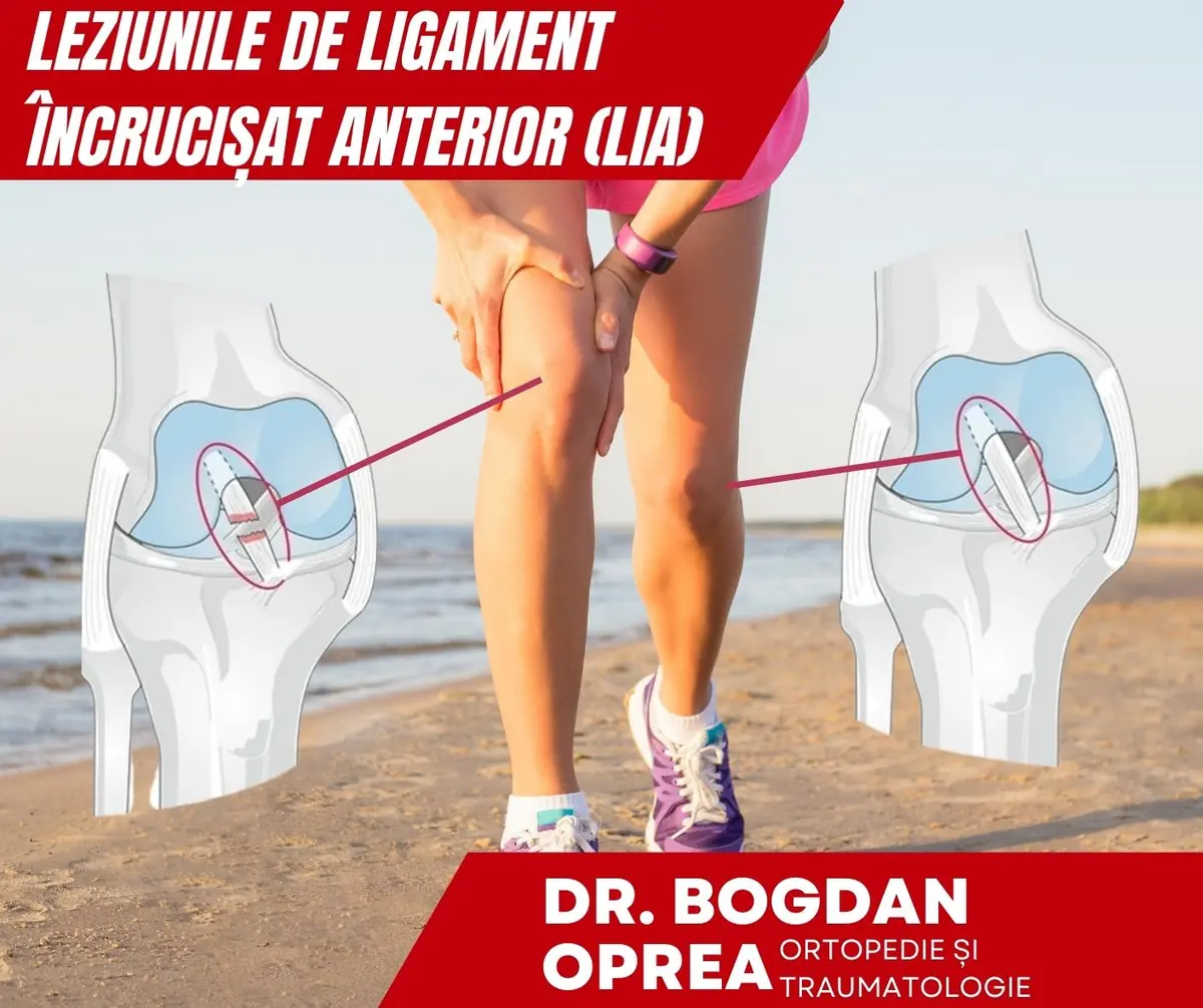 Sfatul Medicului-Leziunile de ligament încrucișat anterior în rândul sportivilor
